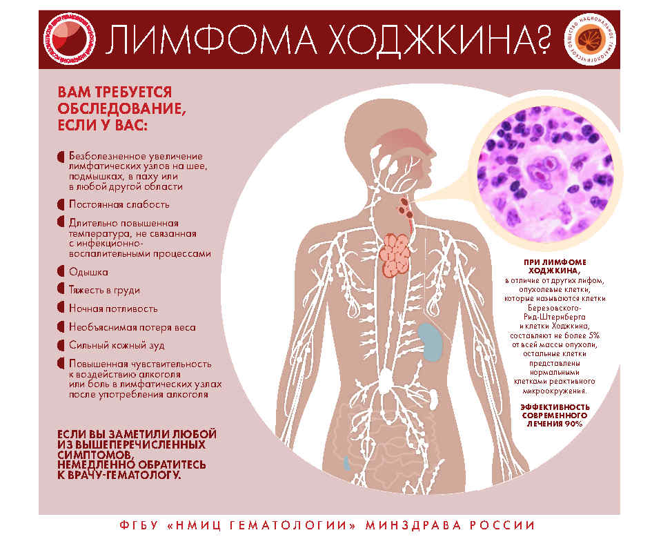 Инфографика Page5